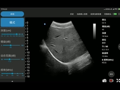 セリウムはアンドロイドおよびiOSシステムと互換性がある3.6MHz凸の調査を示した