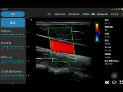 12MHz無線Iphoneの超音波の走査器の電子線形配列