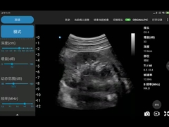 セリウムは3.6MHz携帯用Wifiの超音波の走査器JPEG BMP PNG MPEG-4を示した