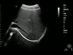 ISO13485携帯用医療機器の凸の調査の手持ち型の健康の走査器