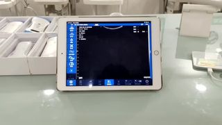 産婦人科診断用デュアルヘッドワイヤレス超音波プローブ