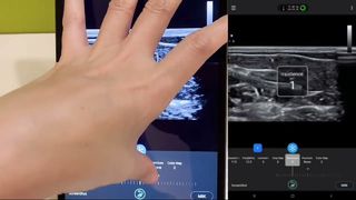 Golead 脳底静脈用リニア超音波プローブ