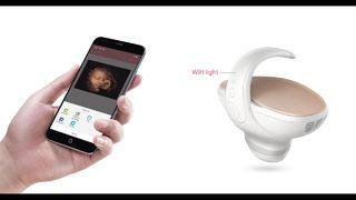 Marvoto 胎児カメラ M1 - 3D ハンドヘルド超音波検査