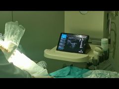 麻酔に使用される Golead ワイヤレス超音波