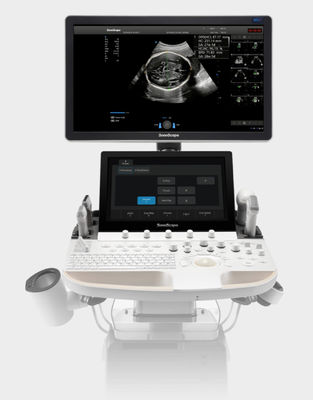 購入 人工知能はSonoScapeの超音波機械トロリーP60 Exp.を基づかせていた online manufacture