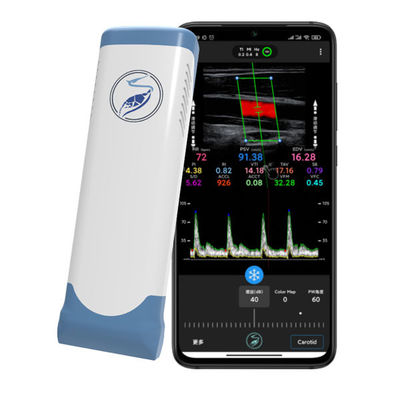 購入 iPhone & iPad 用 12MHz ワイヤレス ハンドヘルド超音波スキャナ |電子リニアアレイカラードップラープローブ online manufacture