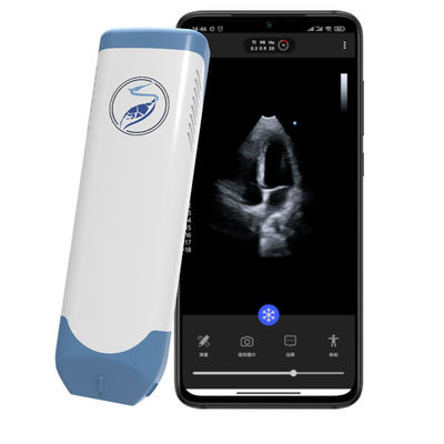 購入 ワイヤレスフェーズドアレイハンドヘルド超音波スキャナ 5MHz ポケット心臓超音波 POCUS 心エコー検査用 online manufacture