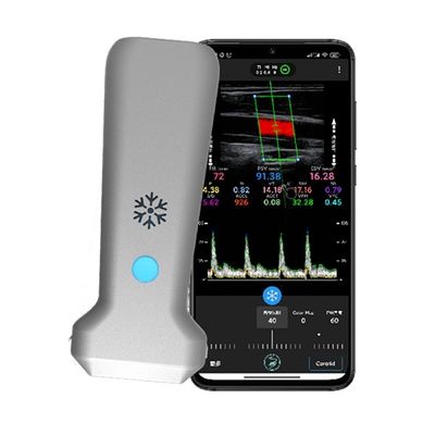 購入 WiFi ワイヤレス リニア ハンドヘルド カラー ドップラー超音波スキャナ | 30 FPS リアルタイム イメージング |ポータブル医療用超音波プローブ online manufacture