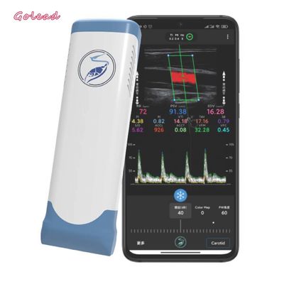 購入 電子線形配列のWifiの無線携帯用超音波の走査器12MHz online manufacture