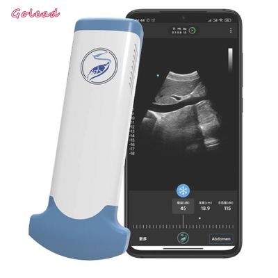 購入 電子凸の配列の携帯電話のための無線超音波装置 online manufacture
