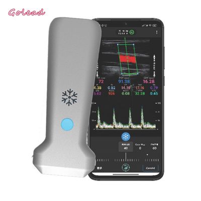 購入 126mmの管MSKの神経のための凸の調査の超音波の走査器 online manufacture