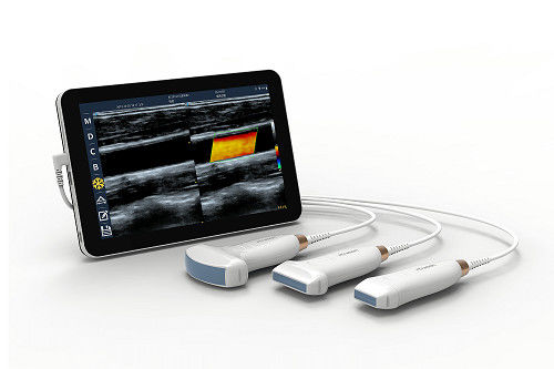 購入 USB Type-C リニアハンドヘルド超音波スキャナ 10MHz ポータブル Android 超音波プローブ (血管および POCUS 用) online manufacture