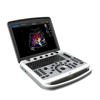 購入 120°回転Chison SonoBook 6のポータブルのラップトップの超音波機械 online manufacture