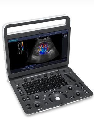 購入 15.6inch LED Sonoscape E1 Exp.の超音波機械BWの超音波 online manufacture