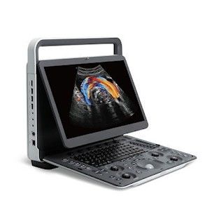 購入 パノラマ式 イメージ投射SonoScape E2のプロ携帯用超音波機械 online manufacture
