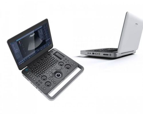 購入 スマート15.6の」LCDが付いている500GBラップトップのSonoScapeの超音波機械を見なさい online manufacture
