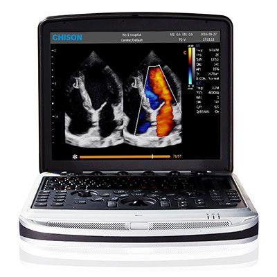 購入 4D Chison SonoBook 9のラップトップの超音波機械を運ぶこと容易 online manufacture