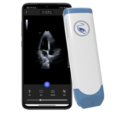購入 深さ18.9cmのIphone 3.6MHzのための手持ち型の超音波の走査器 online manufacture