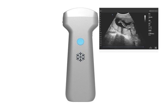 購入 電子凸の配列の凸の無線超音波の調査2MHz 3.6MHz 5MHz online manufacture