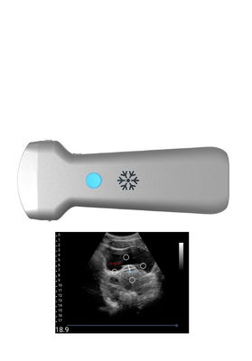 購入 UltrasonicationのGynecologyのための凸の無線超音波の調査 online manufacture