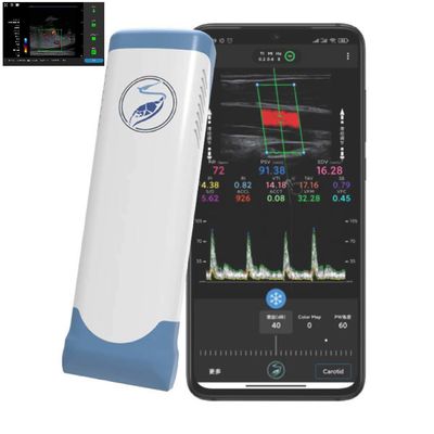 購入 PICCのための256の走査線Ipadの超音波のトランスデューサーの無線超音波の調査 online manufacture