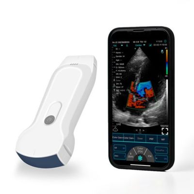 購入 POCUS 臨床診断用ポータブル IPad ハンドヘルド超音波スキャナー online manufacture