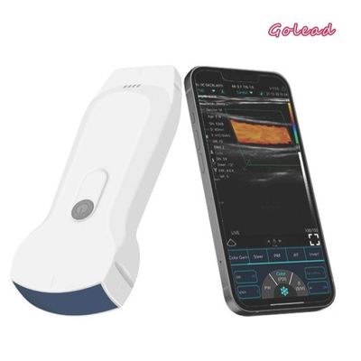 購入 手持ち型の超音波の走査器128の要素のwifiの超音波12か月の保証のUSG online manufacture