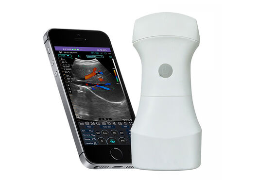 購入 ポータブル臨床画像用の交換可能なバッテリーを備えたワイヤレスポケットコンベックス超音波スキャナー online manufacture