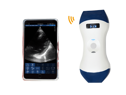 購入 FDA CE ISO13485 手のひらサイズのワイヤレスハンドヘルド超音波プローブ、フェーズドアレイおよびリニアデュアルヘッド付き POCUS 用 online manufacture