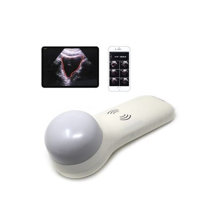 購入 ポイントオブケア尿量測定用ワイヤレス 4D ポータブル膀胱スキャナ online manufacture