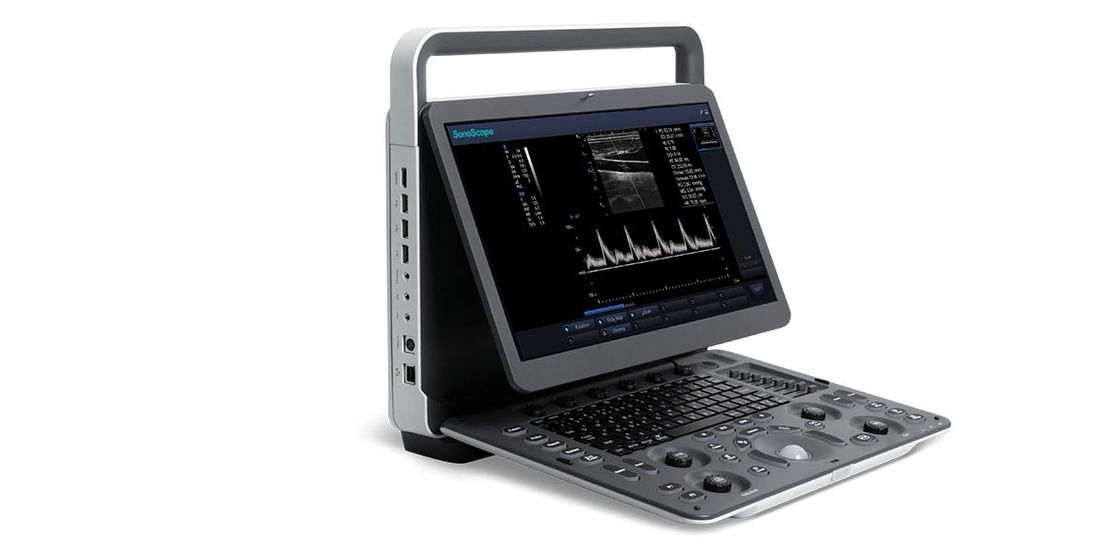 15.6インチLED SonoScape携帯用色のドップラー超音波機械BWの超音波