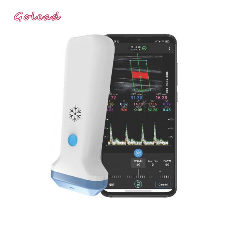 12MHz 3000mAhのIphoneのための無線調査のタイプ超音波の走査器