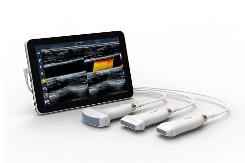 USB Type-C リニアハンドヘルド超音波スキャナ 10MHz ポータブル Android 超音波プローブ (血管および POCUS 用)