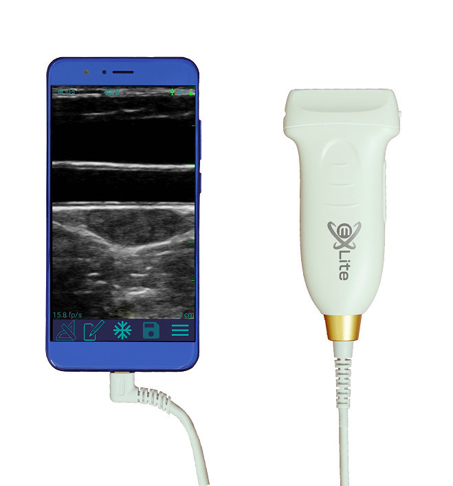 USB Type-C リニアハンドヘルド超音波スキャナ 10MHz ポータブル Android 超音波プローブ (血管および POCUS 用)