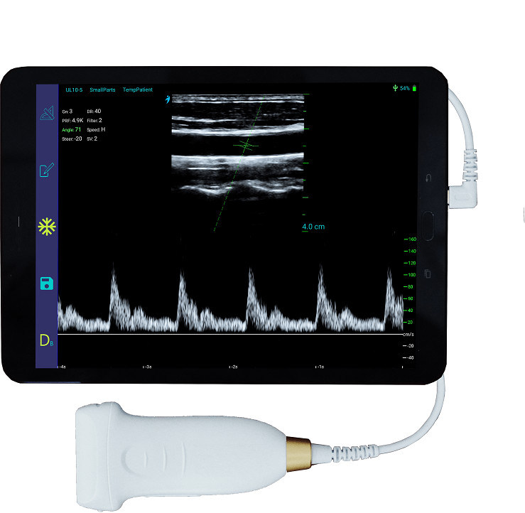 USB Type-C リニアハンドヘルド超音波スキャナ 10MHz ポータブル Android 超音波プローブ (血管および POCUS 用)
