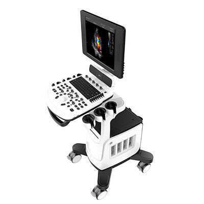 15インチLEDの色のドップラー超音波の走査器Chison Qbit 5