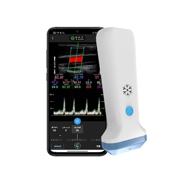 ポータブルカラードップラーワイヤレスリニア超音波スキャナー 12.6 センチメートルハンドヘルド POCUS 超音波医療専門家