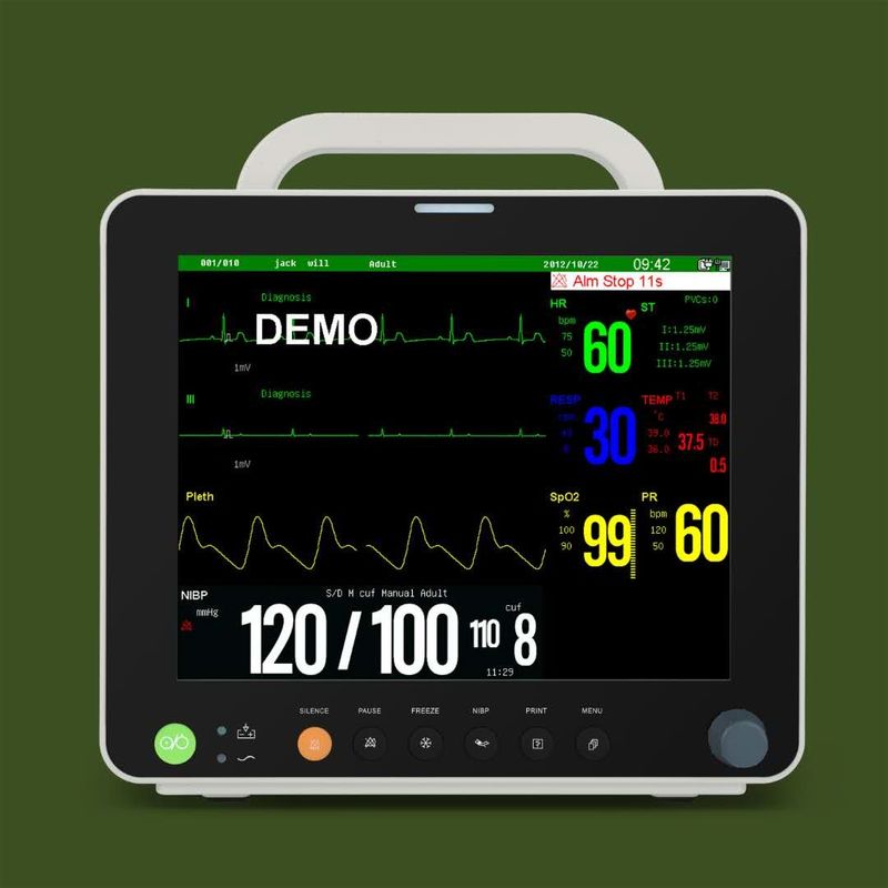 12.1の」ECGの色TFTの表示獣医の多変数忍耐強いモニター