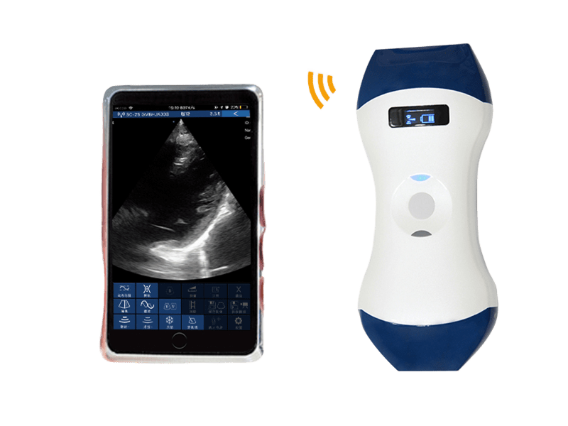 FDA CE ISO13485 手のひらサイズのワイヤレスハンドヘルド超音波プローブ、フェーズドアレイおよびリニアデュアルヘッド付き POCUS 用
